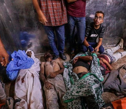 La herida de Gaza, vergüenza de Europa La herida de Gaza, vergüenza de Europa